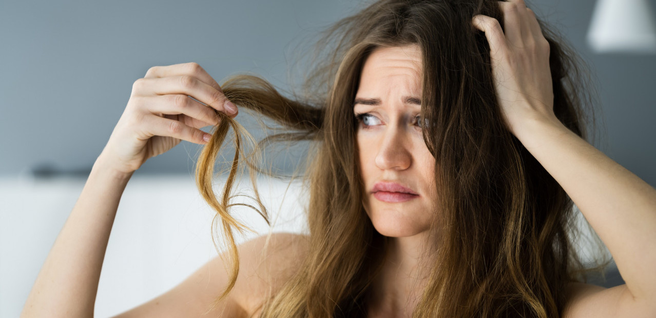 KLJUČNI RAZLOG: Evo zašto dolazi do opadanja kose