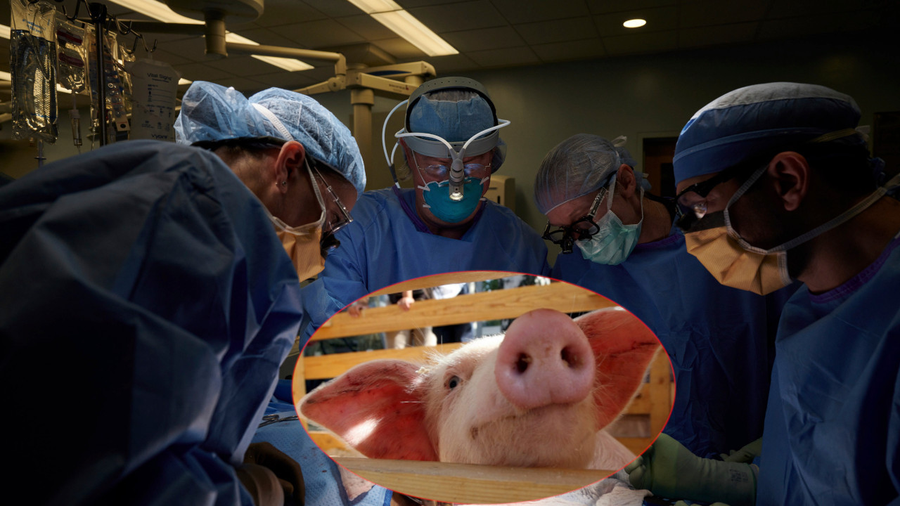 МЕДИЦИНА: Амерички хирурзи пресадили свињски бубрег човеку