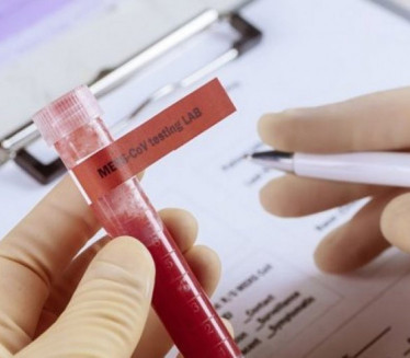 Srbija opet na crvenoj listi Bugarske, potreban PCR test