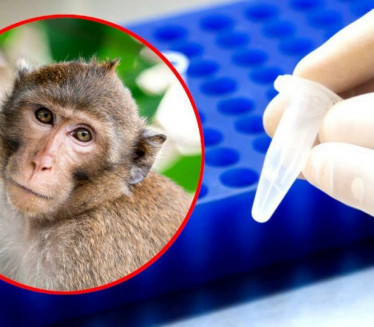 ПРВИ СЛУЧАЈ У ОКРУЖЕЊУ: Потврђена зараза мајмунским богињама