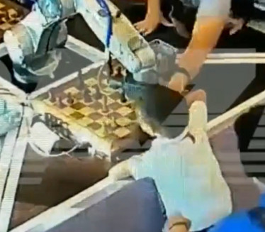 УЖАС У МОСКВИ: Робот сломио прст дечаку (7) током меча