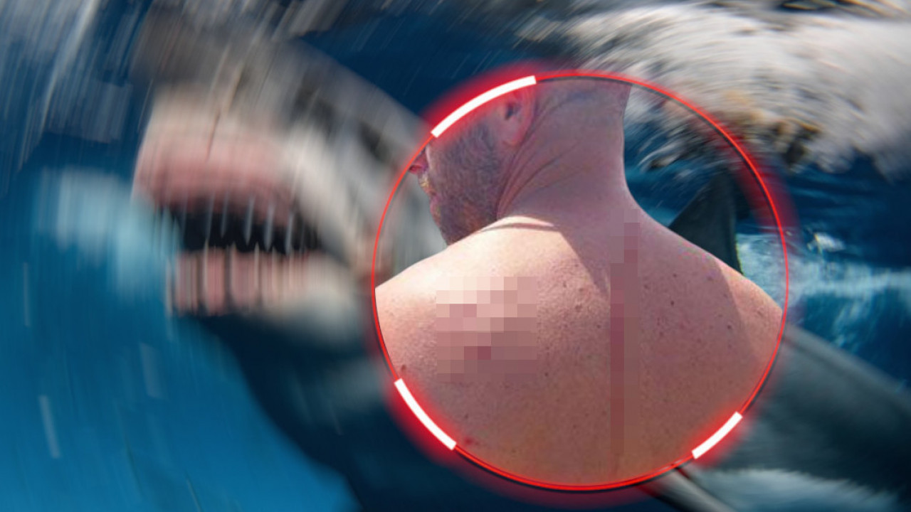 НЕВЕРОВАТНА ПРИЧА: Ајкула га напала и тако му спасила живот