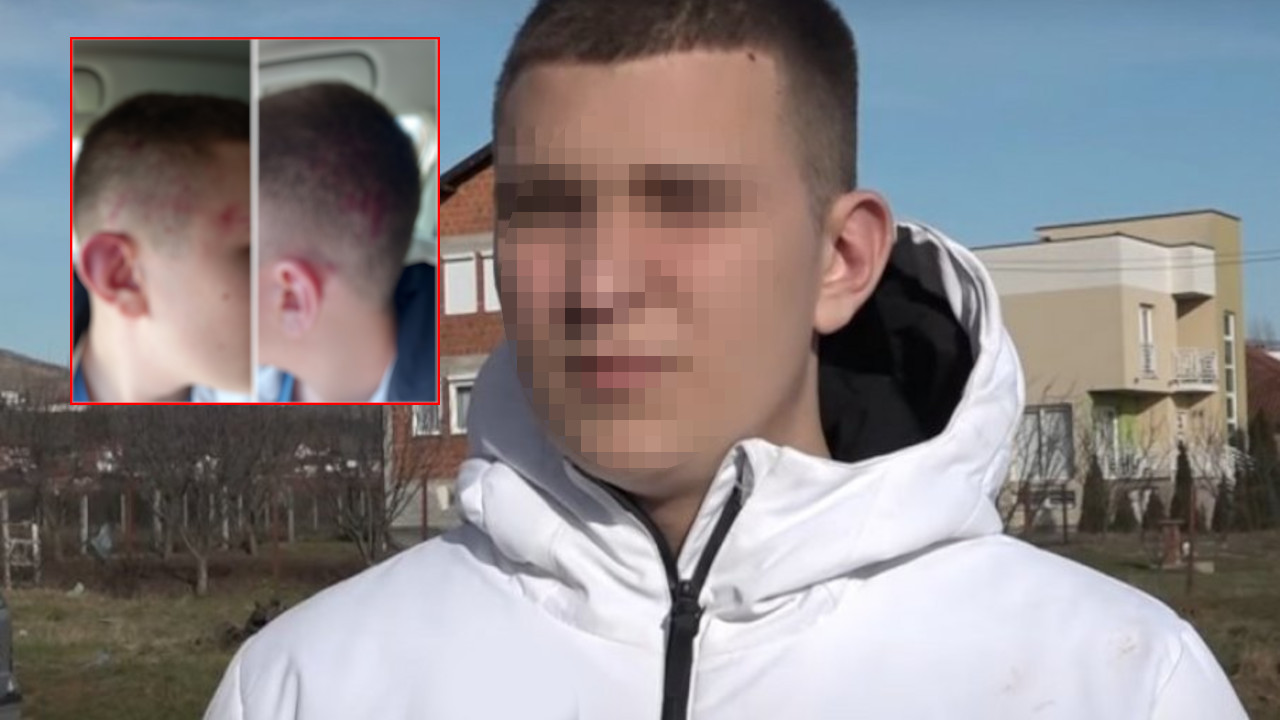 UHAPŠEN JEDAN NAPADAČ: Uhvaćen Albanac koji je napao Lazara