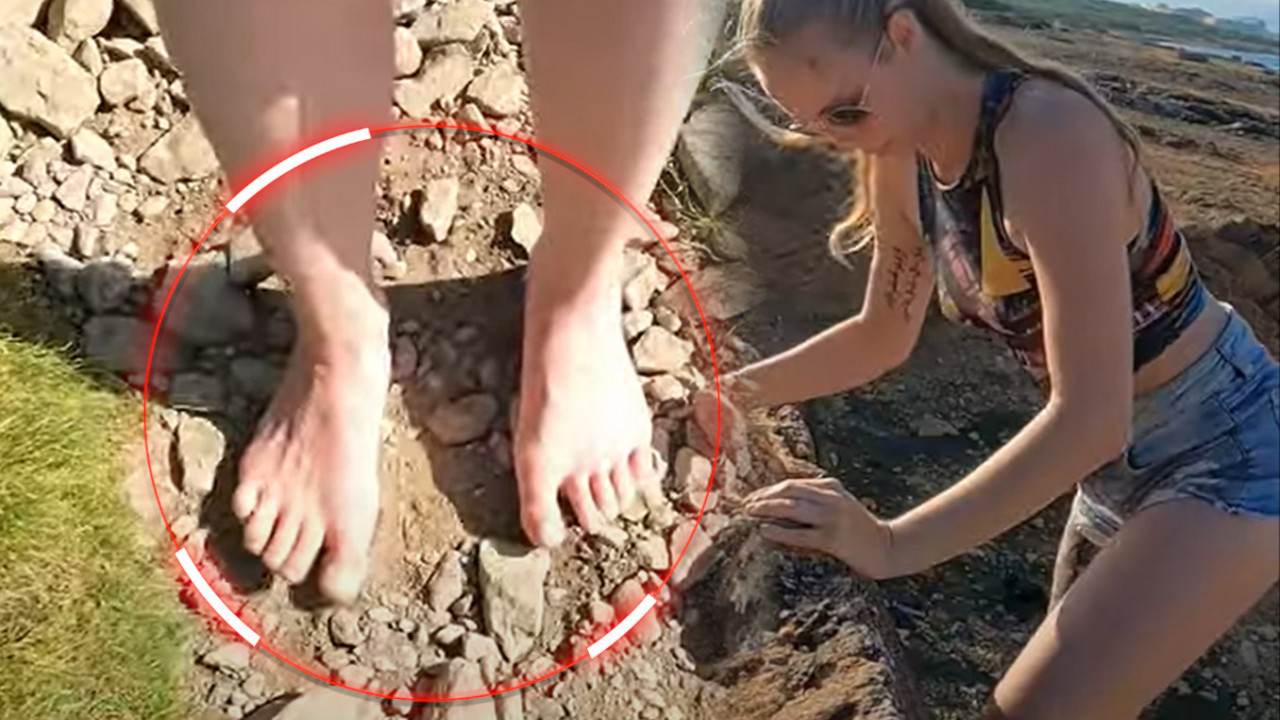 GODINU DANA NE NOSI OBUĆU U kakvom stanju su joj sada stopala