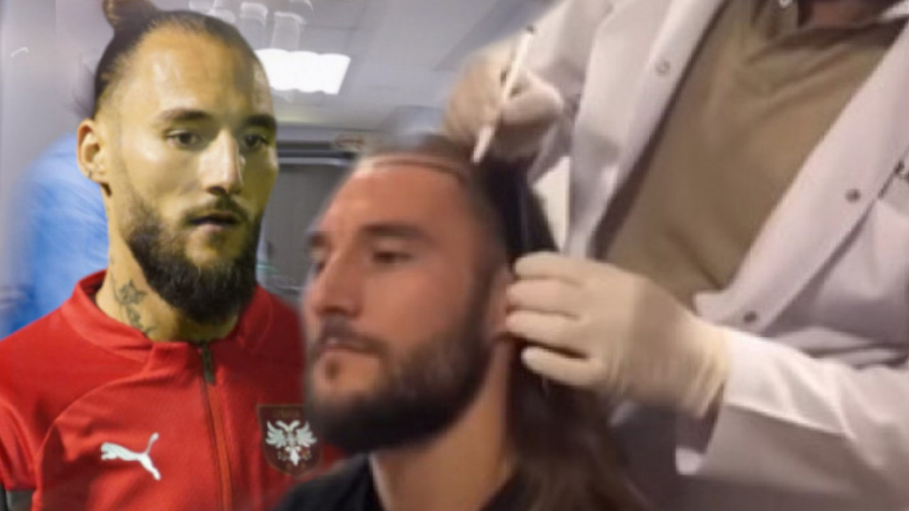 BEZ OŽILJAKA I RANA NA GLAVI Novo izdanje Gudelja nakon zahvata