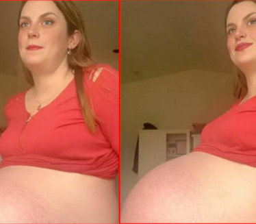 ЖЕНА ДОБИЛА ТРОЈКЕ: Дан пред порођај показала огроман стомак