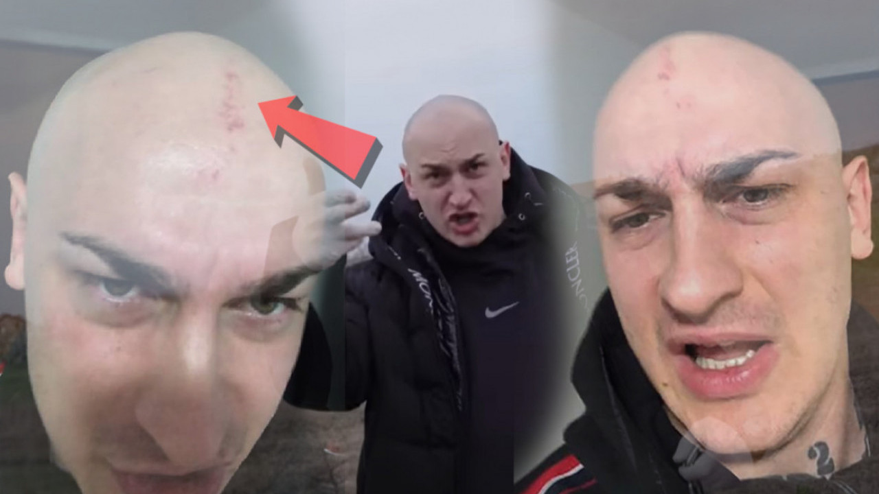 BAJO, NE ZNAM! Desingerica pokazao povrede sa nastupa u HRV