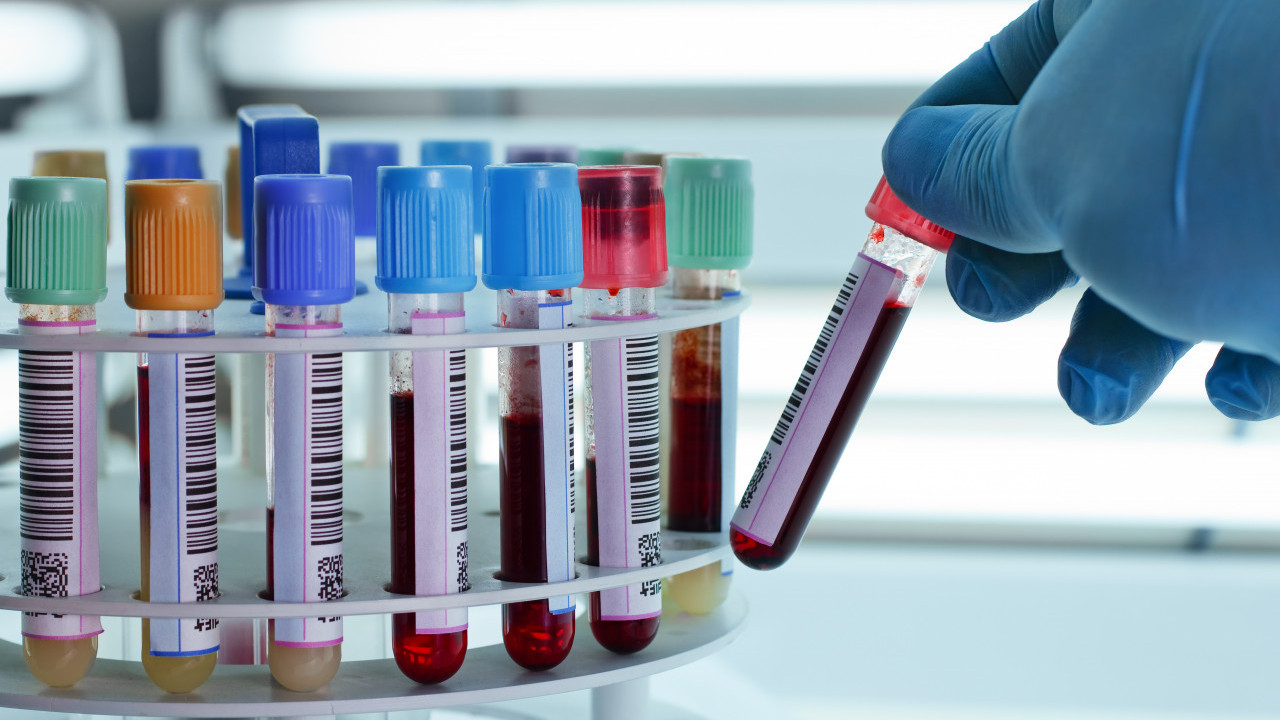 ЗЛАТНА КРВ: Ову крвну групу имају само 43 особе на свету