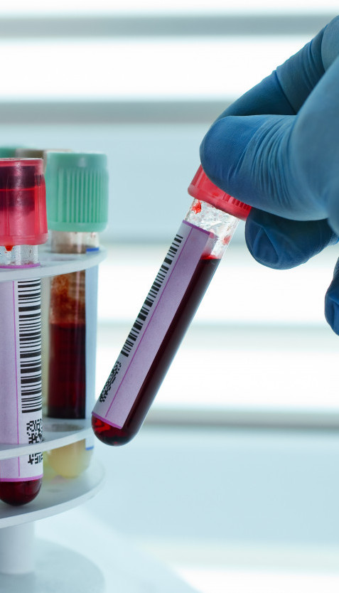 ZLATNA KRV: Ovu krvnu grupu imaju samo 43 osobe na svetu