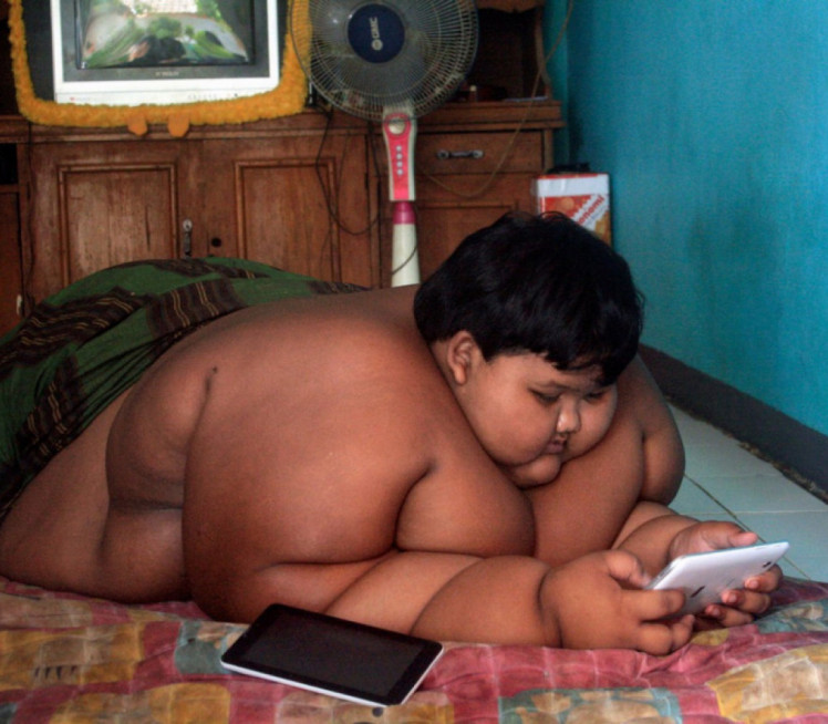 ИМАО 192 КГ: Најдебљи дечак на свету данас НЕПРЕПОЗНАТЉИВ