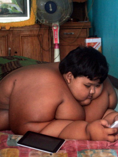 ИМАО 192 КГ: Најдебљи дечак на свету данас НЕПРЕПОЗНАТЉИВ