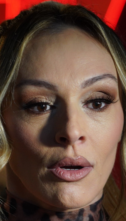 LJUDI TO PRIMEĆUJU Anabela priznala sve o estetskim zahvatima