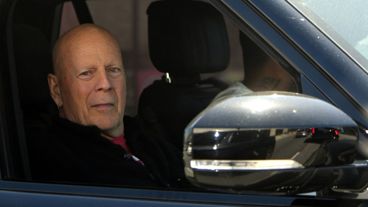 "ДА" ПОРОДИЦЕ: Брусу ће по смрти извадити мозак и дати науци