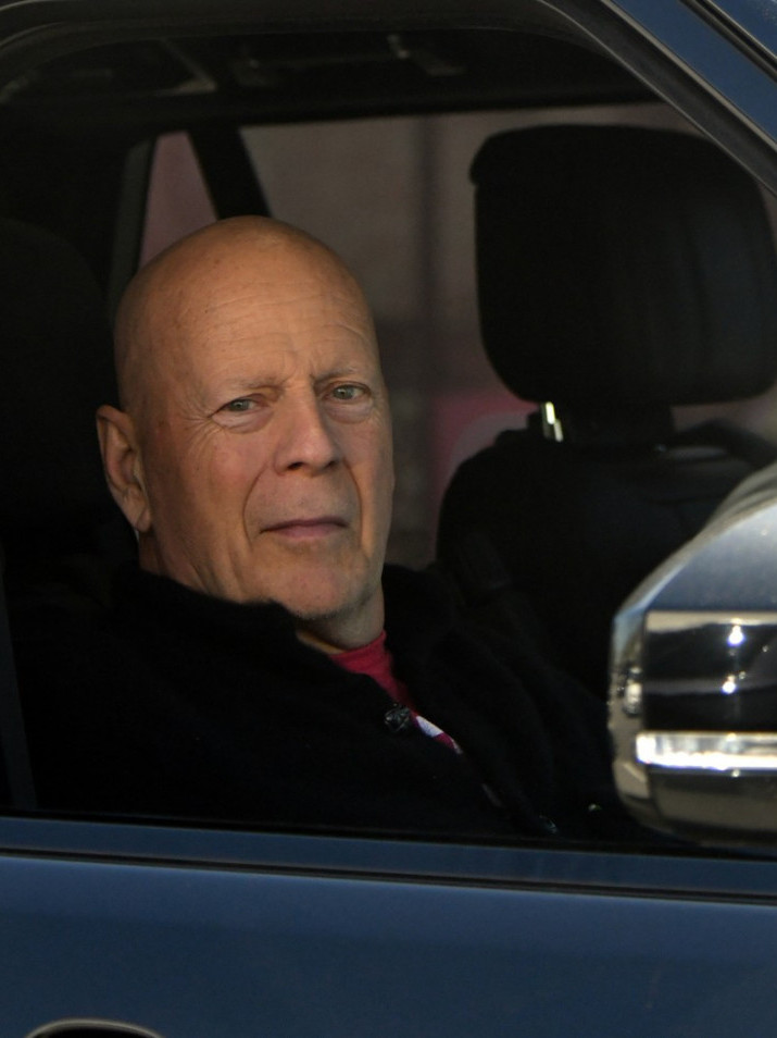 "ДА" ПОРОДИЦЕ: Брусу ће по смрти извадити мозак и дати науци