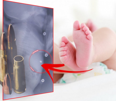 OTAC UPUCAO TRUDNU SUPRUGU: Beba rođena s metkom u telu FOTO