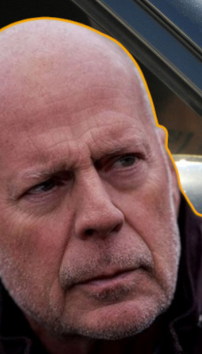 JAVLJAJU SE OKO 65. GODINE: 6 skrivenih znakova demencije