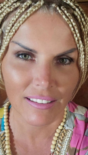 "SAMO SAM ČULA- KARCINOM": Pevačici otkrili rak kože