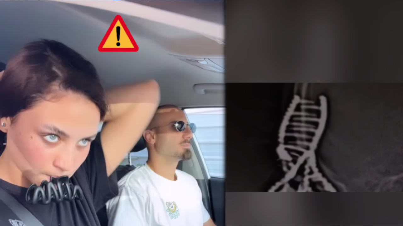 Кад видите снимак, НИКАД нећете носити шналу док се возите