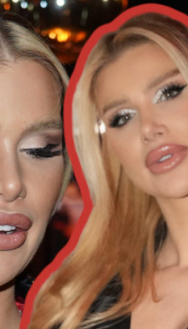 "Roditelji nisu želeli da budem pevačica,nisam imala podršku"