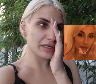 "NE ZNAM ŠTA MI JE BILO": Ruža pala na glavu