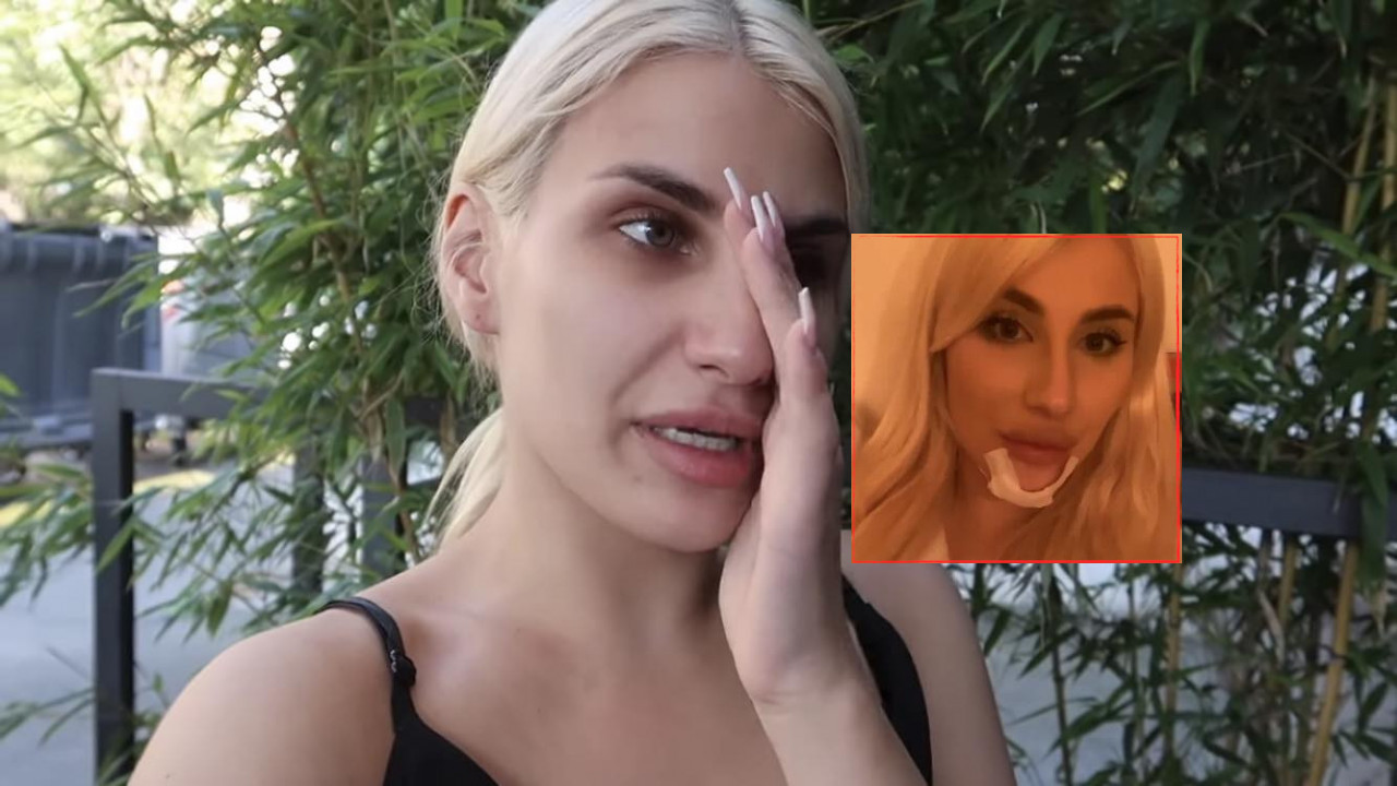 "NE ZNAM ŠTA MI JE BILO": Ruža pala na glavu