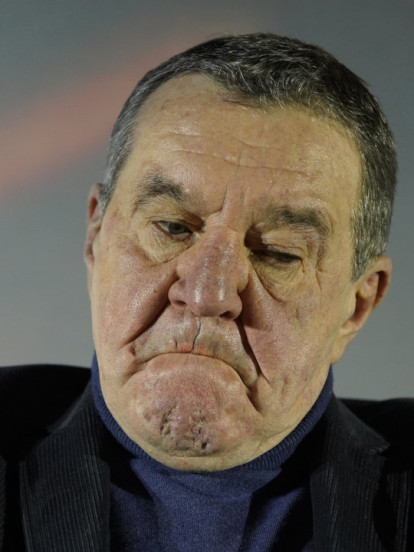 Мики отишао на рутински преглед, па ХИТНО оперисан