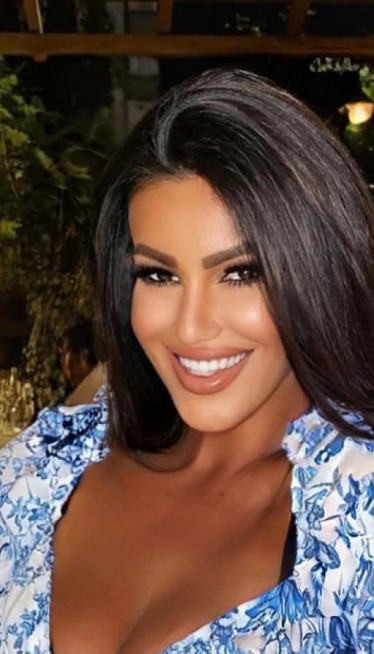 MOGLO JE DA SE DESI DA POLOMIM KUK Pevačica doživela nezgodu