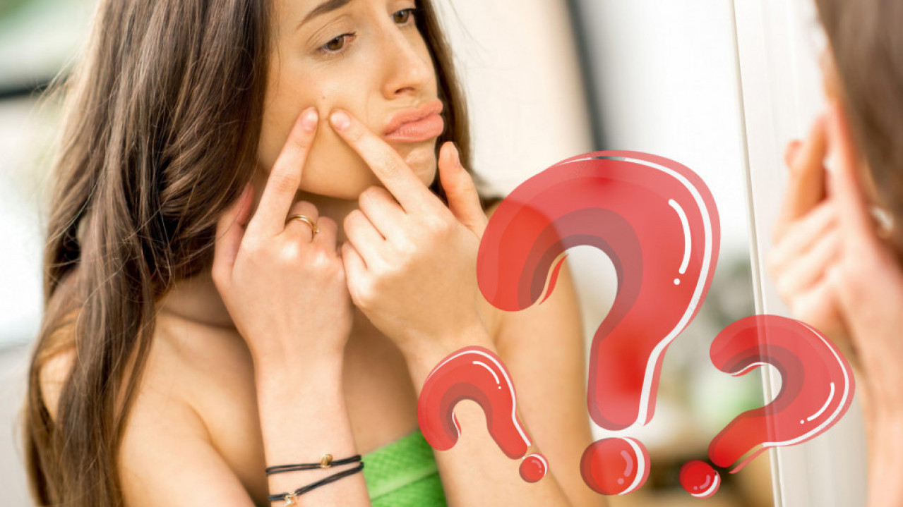 ТРИКОВИ ДАМА: Пет једноставних начина да се решите митисера