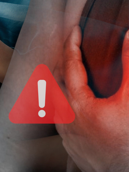 SPAS U 10 SEKUNDI: Kako sebi pomoći u slučaju infarkta