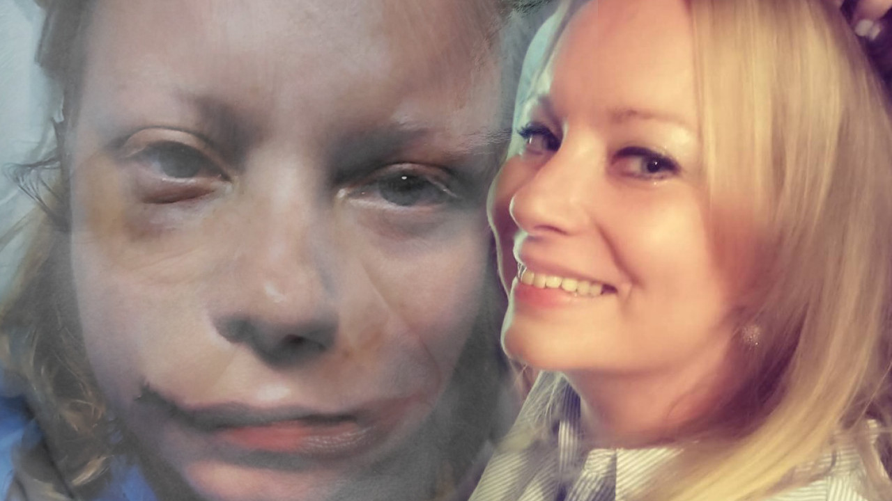 "Skupila sam snage da pokažem kako sam izgledala"