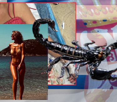 Srpsku voditeljku ujela škorpija u GR - hitno hospitalizovana