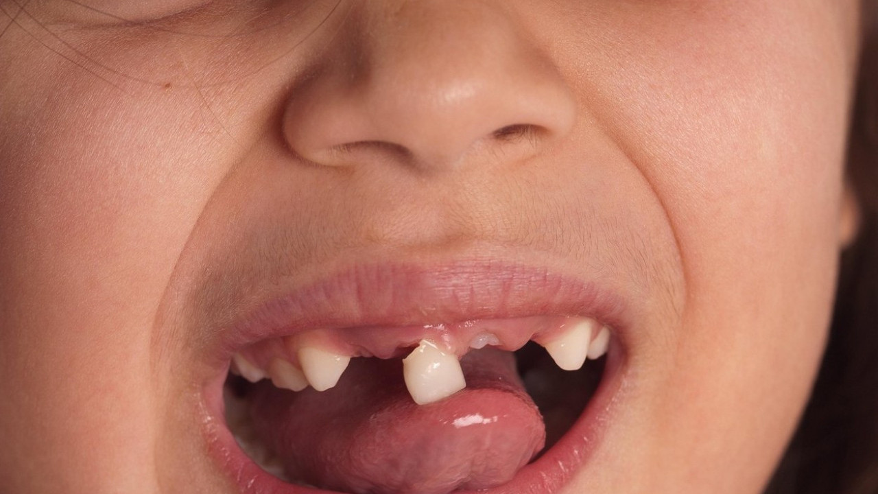 Šta znači kad sanjate da vam ispadaju ili se lome zubi?