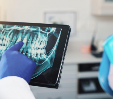Rendgenski snimak zuba otkrio zapanjujuću TAJNU
