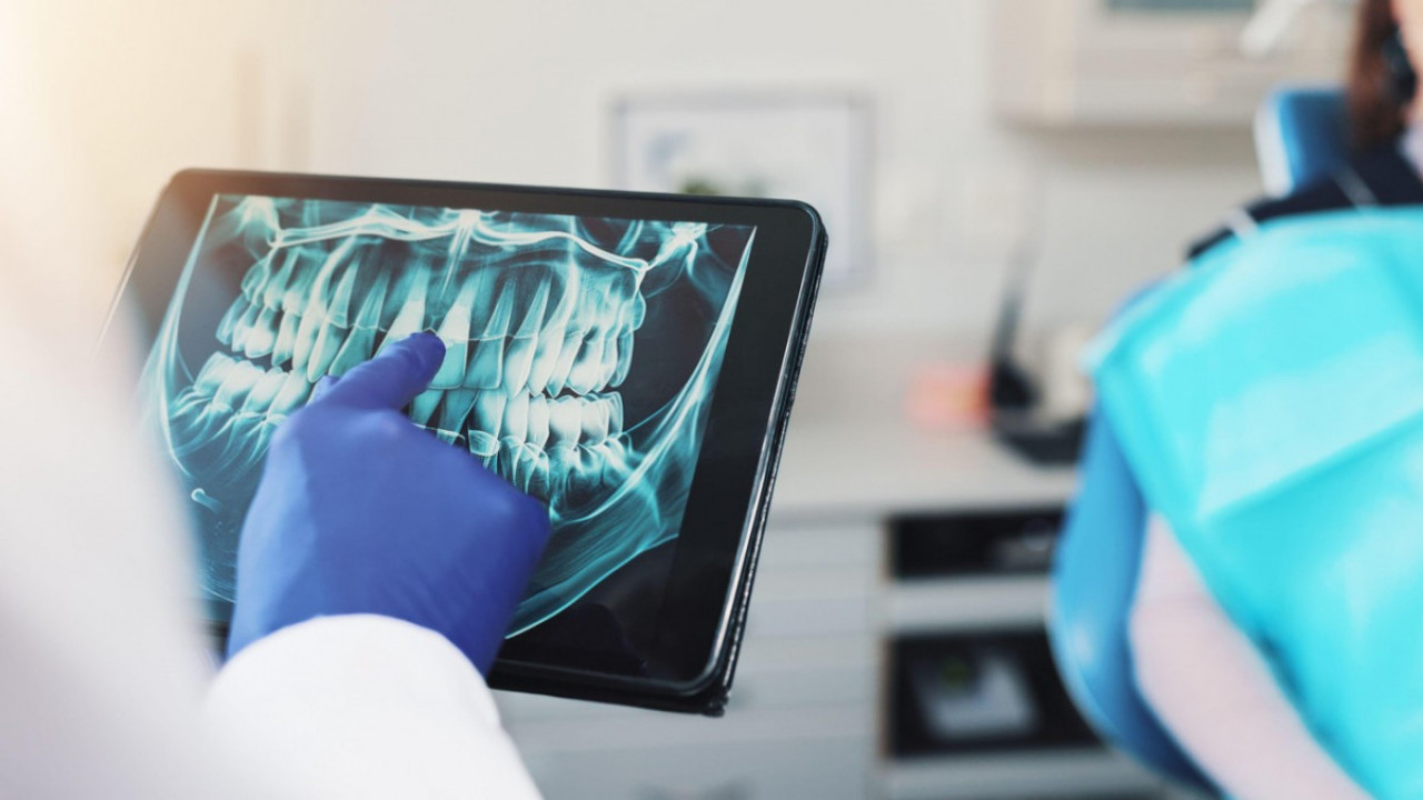 Rendgenski snimak zuba otkrio zapanjujuću TAJNU