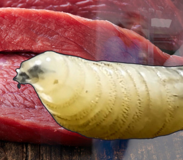 ЦРВ МЕСОЖДЕР У ТЕЛУ ЧОВЕКА: Мува положила јаја у живо ткиво