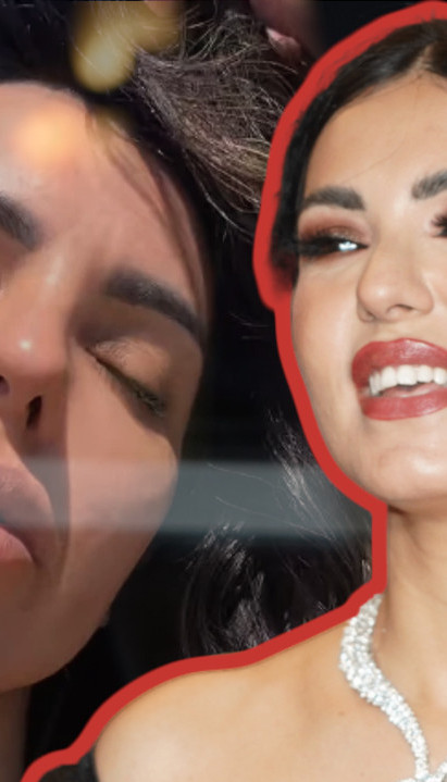 ГОРКО СЕ ПОКАЈАЛА: Тањи Савић филер направио хаос на лицу