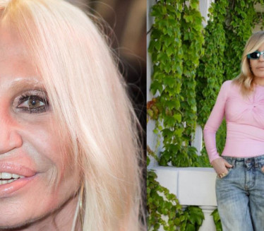 КОНАЧНО НЕ ИЗГЛЕДА КАО СТРАШИЛО: Донатела "убола" хирурга