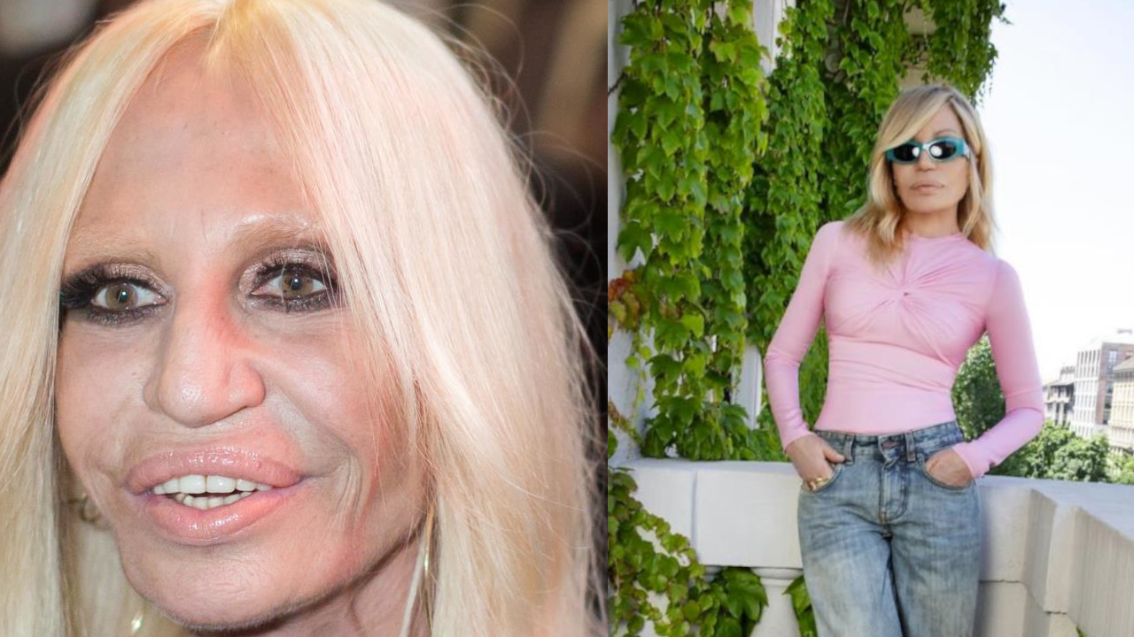 KONAČNO NE IZGLEDA KAO STRAŠILO: Donatela "ubola" hirurga