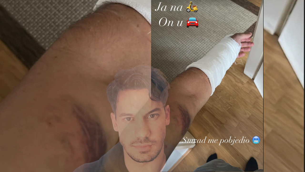 ГЛУМАЦ НАСТРАДАО Петар у гипсу, модрицама:"Смрад ме победио"