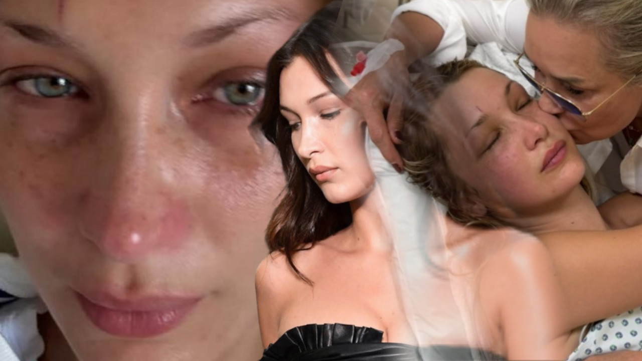 ПОТРЕСНИ СНИМЦИ ИЗ БОЛНИЦЕ Мајка очајна: "Гледам ћерку,пати"