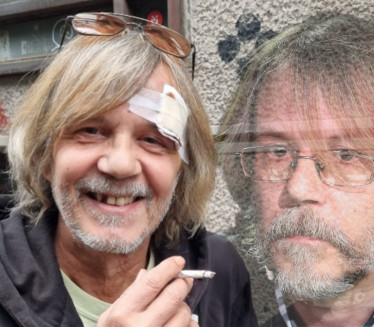 Žika Todorović ostao bez zuba, na glavi krvavi zavoji (FOTO)