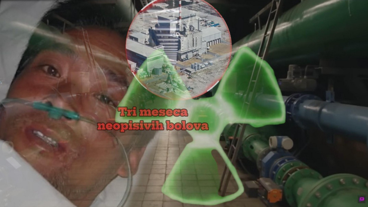 НАЈБОЛНИЈА СМРТ: Плакао крв после нуклеарне катастрофе