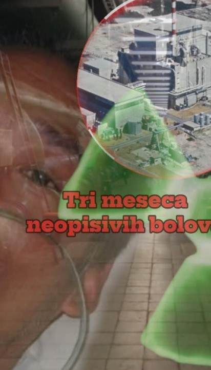 NAJBOLNIJA SMRT: Plakao krv posle nuklearne katastrofe