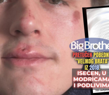 PRETUČEN POBEDNIK "VB-A": Politika, vlada i ljudi hoće podelu