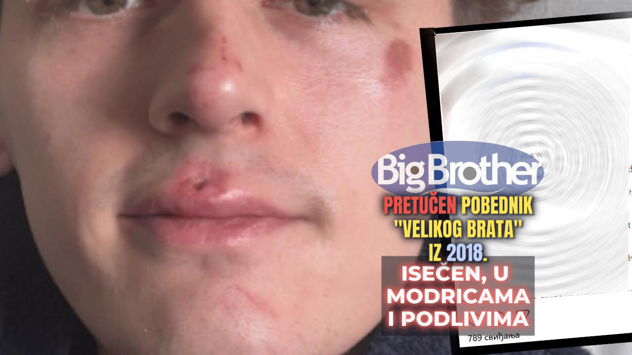 PRETUČEN POBEDNIK "VB-A": Politika, vlada i ljudi hoće podelu