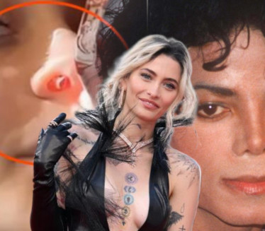 RUPA OD NARKOTIKA: Ćerka Majkl DŽeksona pokazala posledice