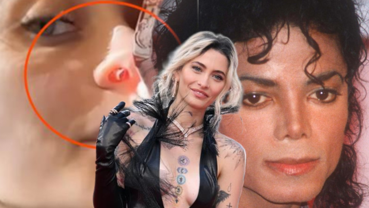 RUPA OD NARKOTIKA: Ćerka Majkl DŽeksona pokazala posledice