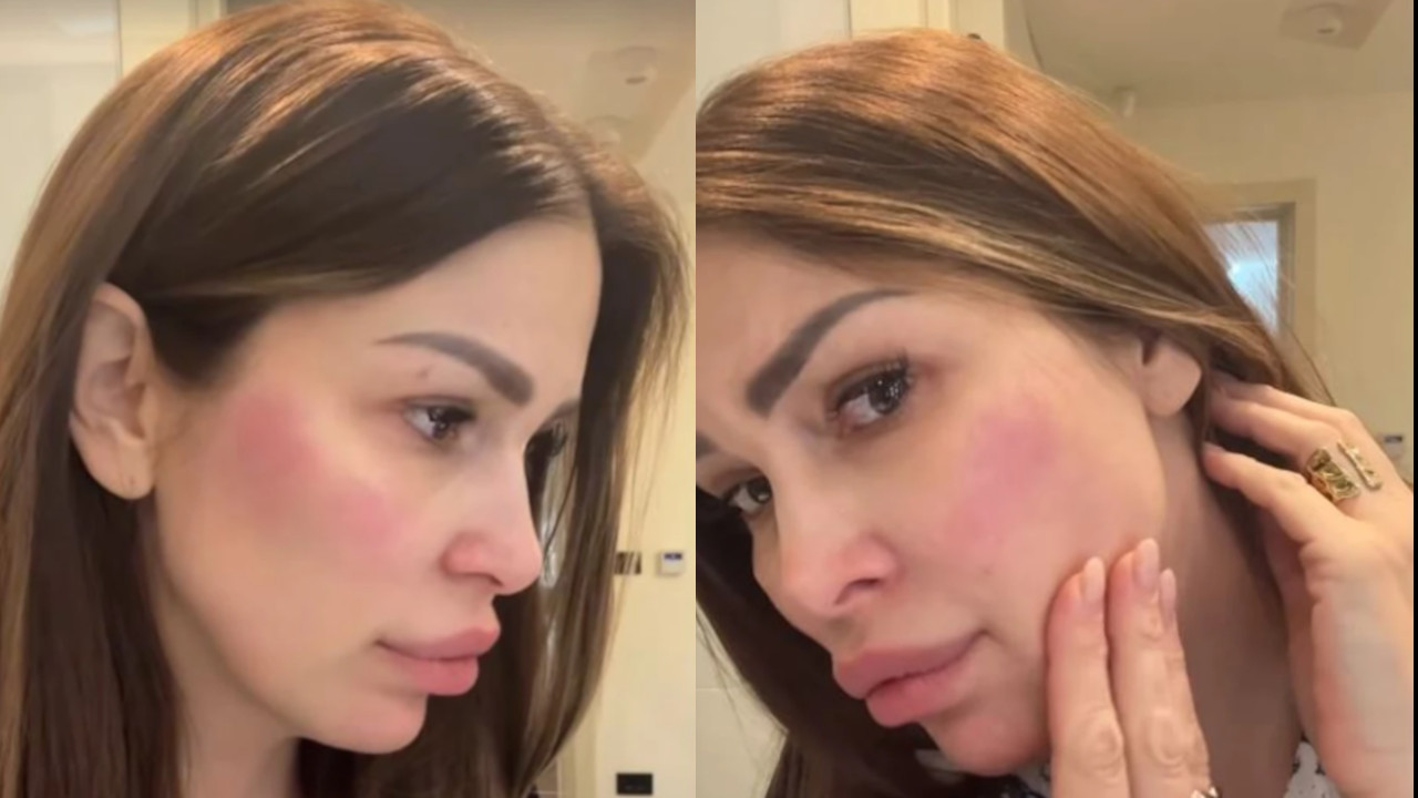 OLJA SVA U PEČATIMA "Mnogo me peče, krećem da se gušim"