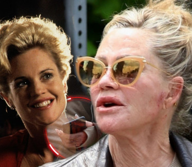 NIJE ZA GADLJIVE: Telo Melani Grift u lošem stanju (FOTO)