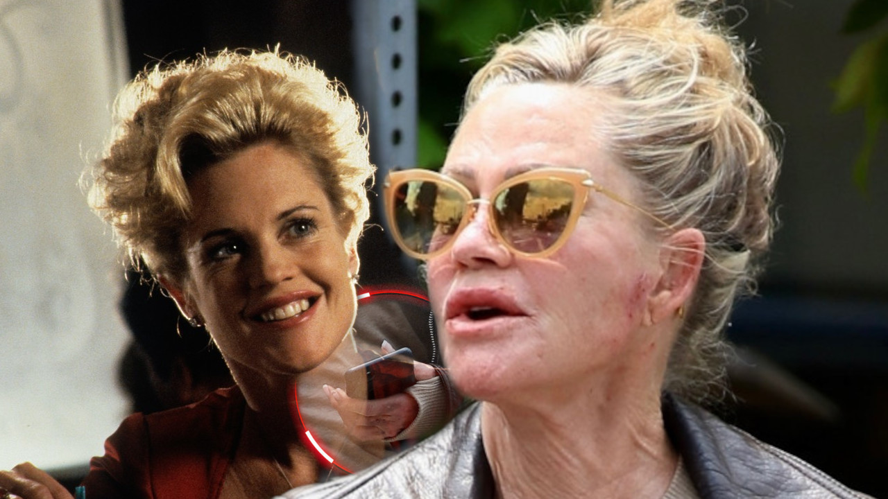 NIJE ZA GADLJIVE: Telo Melani Grift u lošem stanju (FOTO)